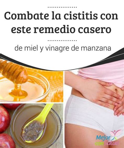 Combate La Cistitis Con Este Remedio Casero De Miel Y Vinagre De