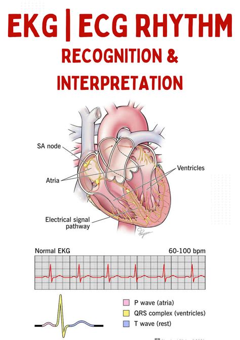 Solution Ekg Ecg Interpretation Studypool