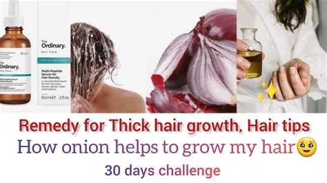 Extreme Hair Growth In 30 Days😳thick Hair How To Grow Hair Fast By