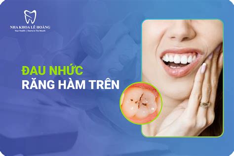 Đau Nhức Răng Hàm Trên Nguyên Nhân Triệu Chứng và Phương Pháp Điều