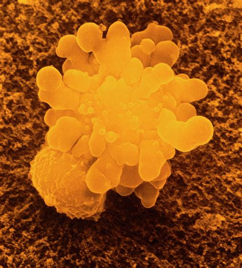 False Colour Sem Of T Lymphocyte Killer Cell By Dr Andrejs Liepins