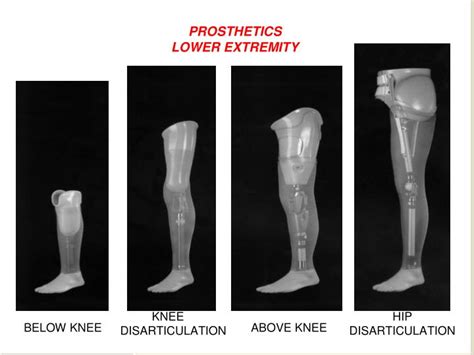 Ppt Rehabilitation Of Lower Limb Amputee By Dr Hassan Hussien El Sharkawy Powerpoint