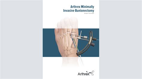 Arthrex Osteotomia De Akin