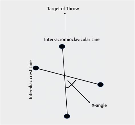 Illustration Depicting The X Angle From A Superior Orientation