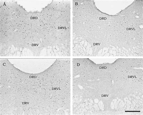 Photomicrographs Of Coronal Sections Of The Anterior Level Of The