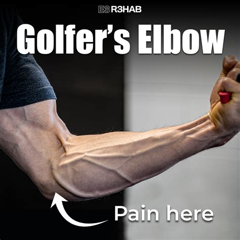 Golfer’s Elbow - E3 Rehab