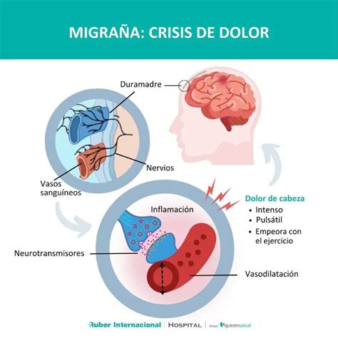 Causas Psicol Gicas De La Migra A Emociones Y Tratamiento Colegio De