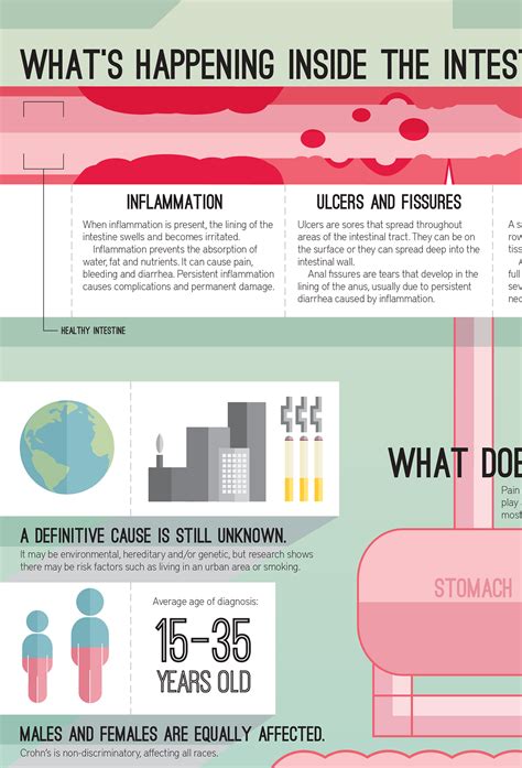 Crohns Disease An Infographic On Behance