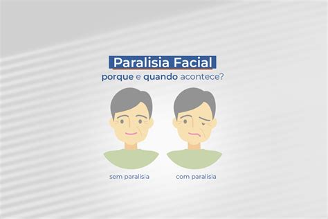 Paralisia Facial Por Que E Quando Acontece Hospital Paulista