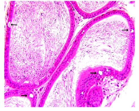 Photomicrograph Of A Section Of Cauda Epididymis Of A Rat From Group 3