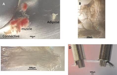 Collection Of Skeletal Muscle Biopsies From The Superior Compartment Of