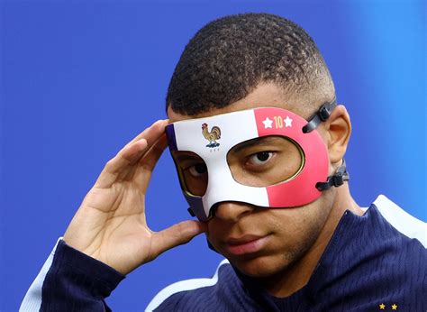 Broken Nose No Barrier Mbappe Cleared To Play Rediff Sports