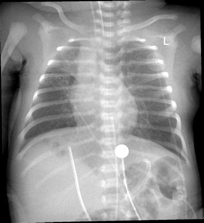 Radiology Quiz Radiopaedia Org