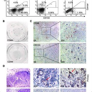 Cd Colorectal Cancer Cells Are More Tumorigenic Than Cd And Cd