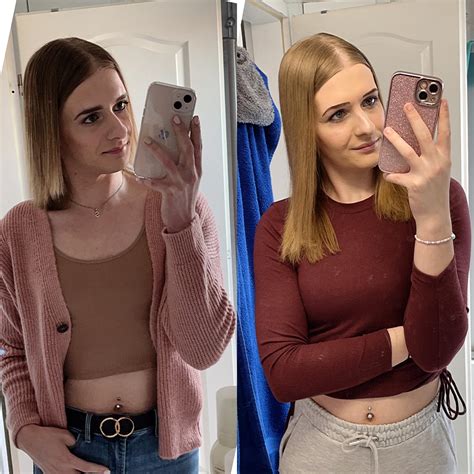 0 Month Vs 12 Month Hrt☺️ What Do You Think R Transtimelines