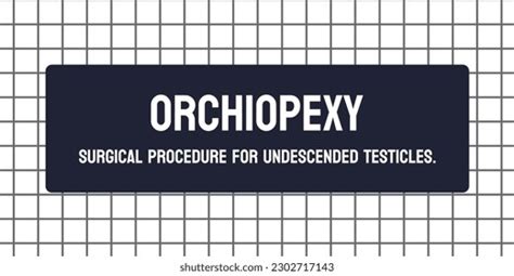 Orchiopexy Surgery Move Undescended Testicles Into Stock Vector ...