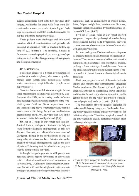 Castleman disease in children: Diagnosis and treatment