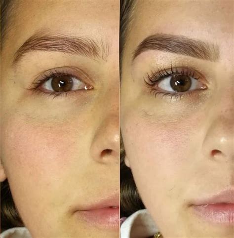 Lash Lifting Saiba Tudo Sobre A Técnica De Cílios Mais Longos