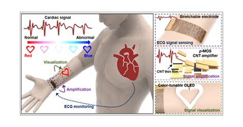 Wearable Electrocardiogram Monitor Using Carbon Nanotube Electronics