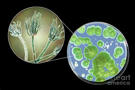 Penicillium Fungus Photograph By Kateryna Konscience Photo Library