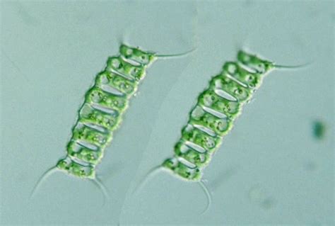 protist images scenedesmus perforatus