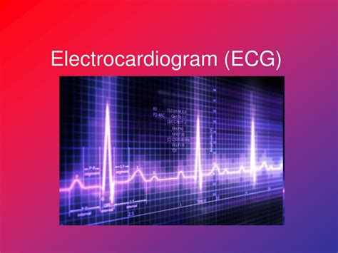 Ppt Electrocardiogram Ecg Powerpoint Presentation Free Download