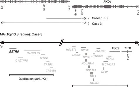 Molecular PKDTS Characterization In The Three TSC Patients A