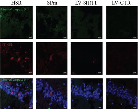 Sevoflurane Postconditioning Attenuated Sirt1 Loss And Cell Apoptosis