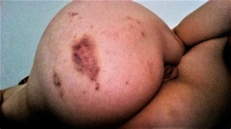 Amateur Ass Punishment XHamster