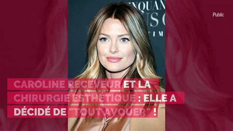 Caroline Receveur et la chirurgie esthétique elle a décidé de tout