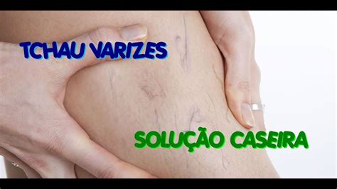 Receita Caseira Para Eliminar As Varizes Das Pernas