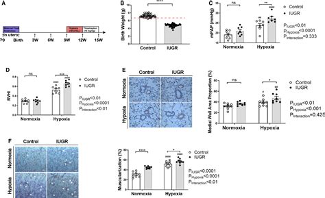 Pvecsderived Exosomal Micrornas Regulate Pasmcs Via Foxm Signaling In