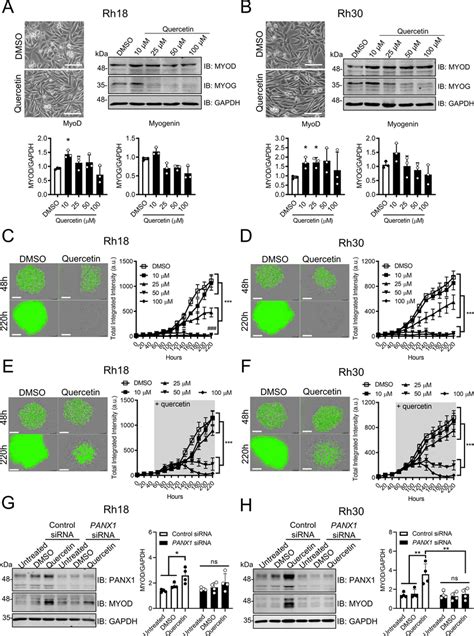 Quercetin Induces Partial Differentiation Of RMS Cells In A