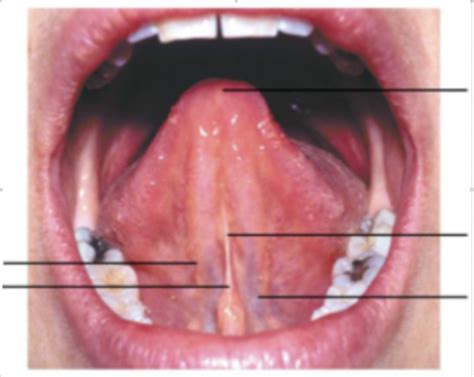 Diagram Of Ventral Surface Of Tongue Quizlet