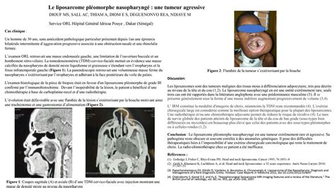 Le liposarcome pléomorphe nasopharyngé une tumeur agressive La