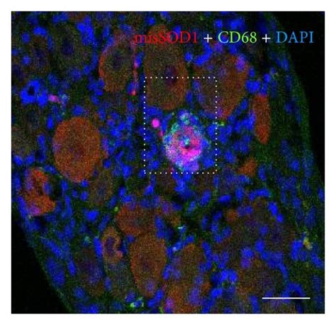 A C Misfolded SOD1 MisSOD1 Immunolabeling Using AJ10 Antibody