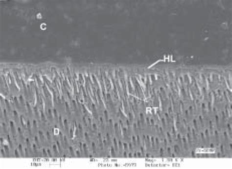 Sem Photomicrograph Illustrating The Resin Dentin Interface Reached