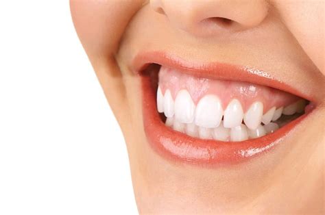 Gummy Smile Treatment In Newport Beach Center For Restorative