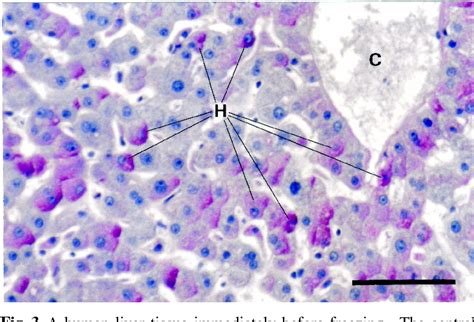 Figure 1 from Histological Study on Glycogen Granules and Lipid ...