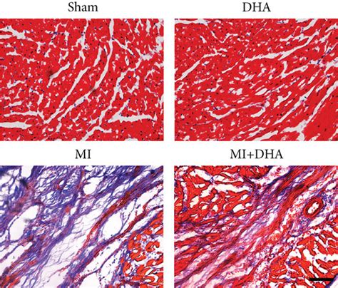 Dha Improved Mi Induced Cardiac Dysfunction And Inhibited Cardiac