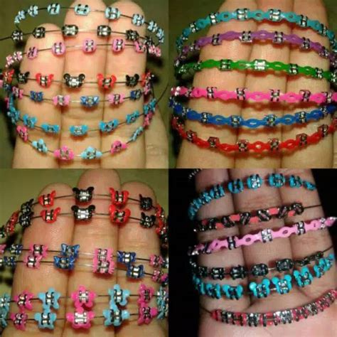 Jual Kawat Behel Gigi Lepas Pasang Motif Cantik Shopee Indonesia