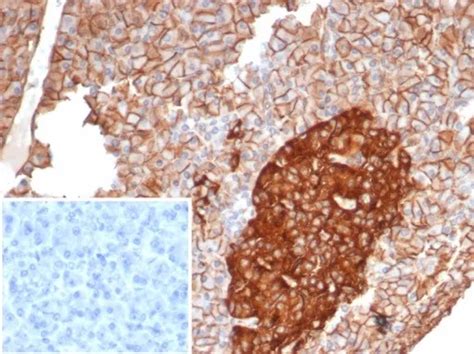 Cd99 Mic2 Ewing S Sarcoma Marker Antibody Clone Mic27865 Gene