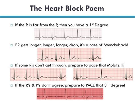 Heart Block Poem – Rish Academy