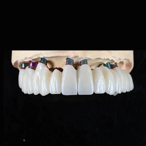 Zirconia Bridge, Zirconia Bridge Cost/Price | Golden Smile Dental Lab