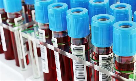 Blood Test That Could Detect Fifty Types Of Cancer Shows Promise In