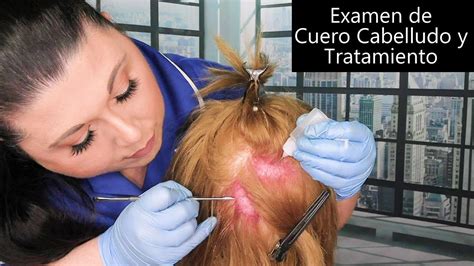 Asmr Espa Ol Scalp Check And Treatment Examen De Cuero Cabelludo Y