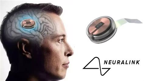 Elon Musks Neuralink Implants Chip In Human Brain For The First Time Said Initial Results Are