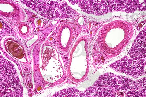 Man Salivary Gland Parotid Transverse Section 125x Salivary Gland