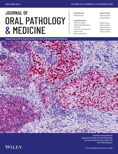 Lncrna Bancr Promotes Oral Squamous Cell Carcinoma Progression Via