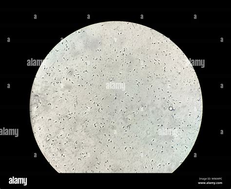 View At Human Sperm Under Microscope In Lab Stock Photo Alamy